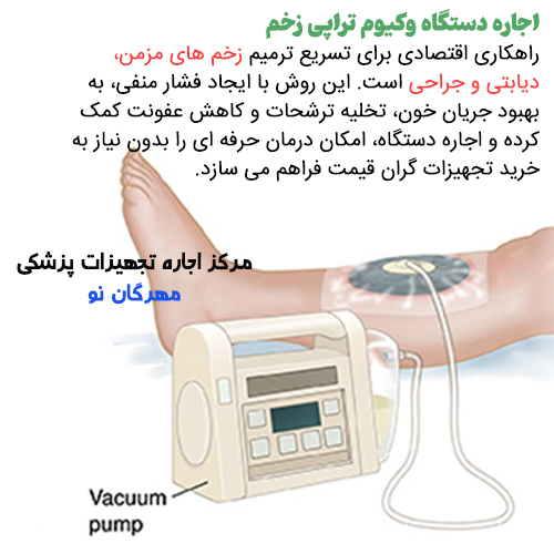 قیمت اجاره دستگاه وکیوم تراپی زخم
